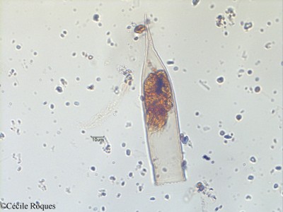 protozoo/Helicostomella subulata (1)(copy)_thumb.jpg